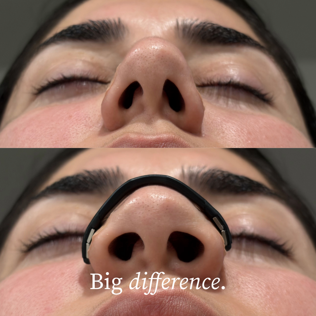 Magnetic Nasal Dilators – Reduce snoring and improve airflow starting tonight