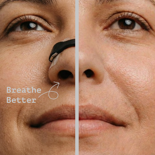 Magnetic Nasal Dilators